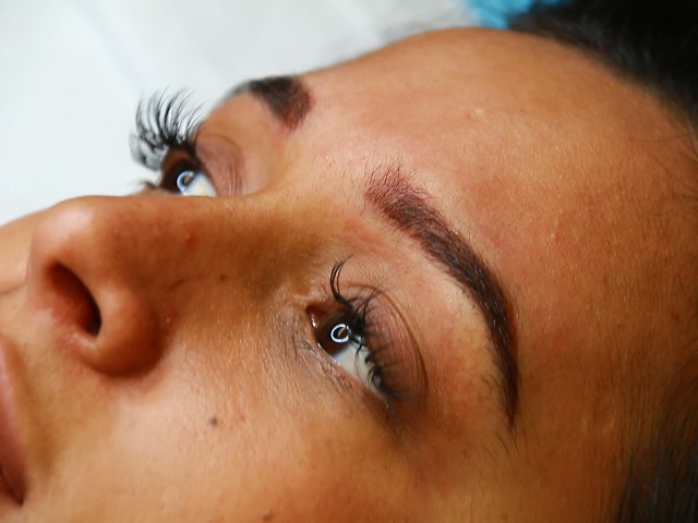 eyelash treatment